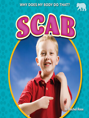 cover image of Scab